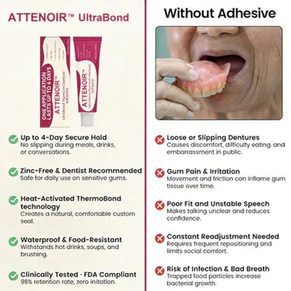 ATTENOIR™ Advanced Dental Adhesive 🔥 Sturdy and comfortable, and zinc-free 🦷